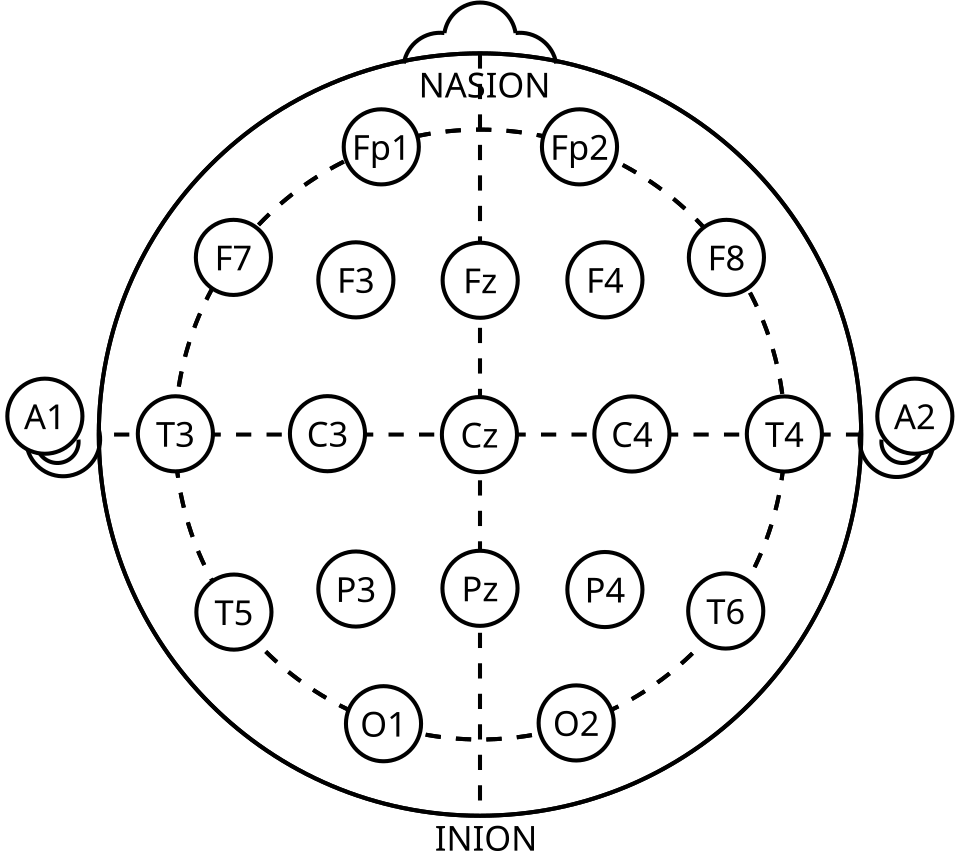 International 10-20 electrode positions, vertex view